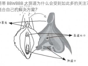 白人荫蒂 BBWBBB 大荫道为什么会受到如此多的关注？如何找到适合自己的解决方案？