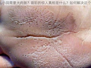 为什么小洞需要大肉肠？背后的惊人真相是什么？如何解决这个问题？