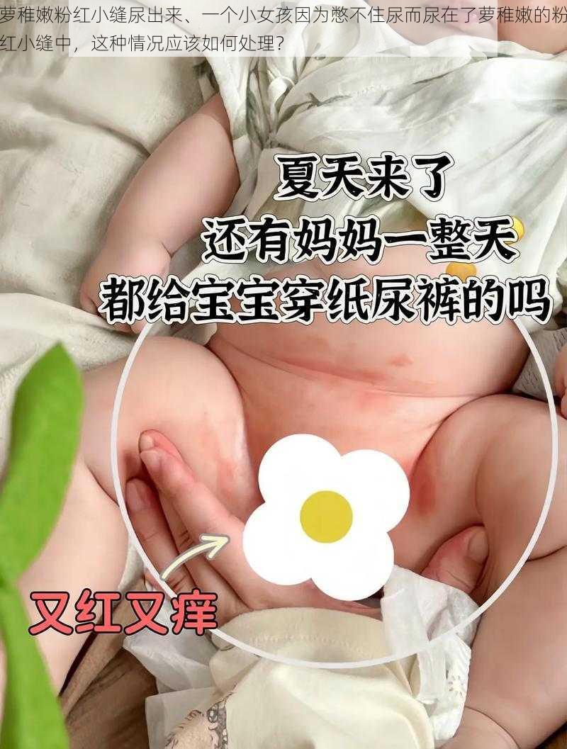 萝稚嫩粉红小缝尿出来、一个小女孩因为憋不住尿而尿在了萝稚嫩的粉红小缝中，这种情况应该如何处理？