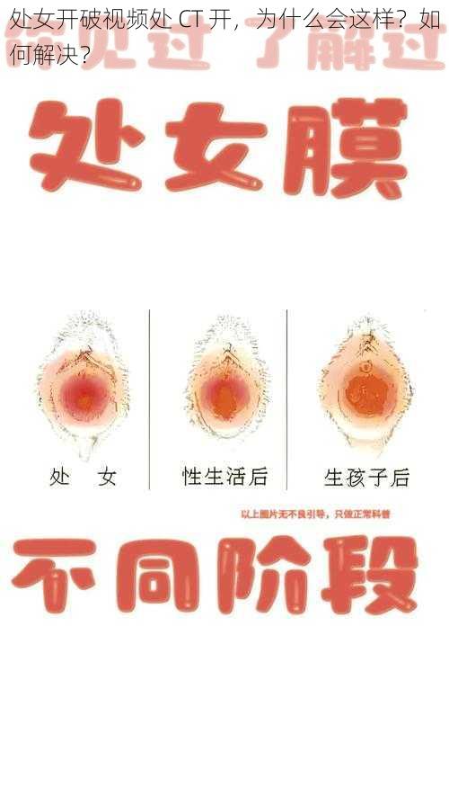 处女开破视频处 CT 开，为什么会这样？如何解决？