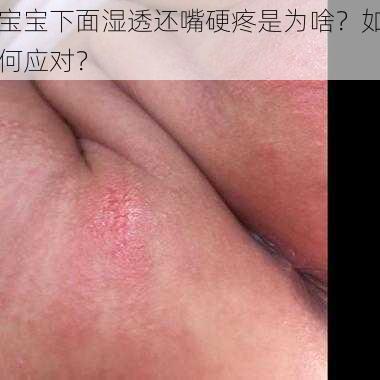 宝宝下面湿透还嘴硬疼是为啥？如何应对？