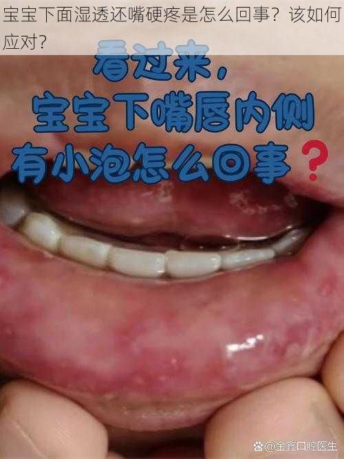 宝宝下面湿透还嘴硬疼是怎么回事？该如何应对？